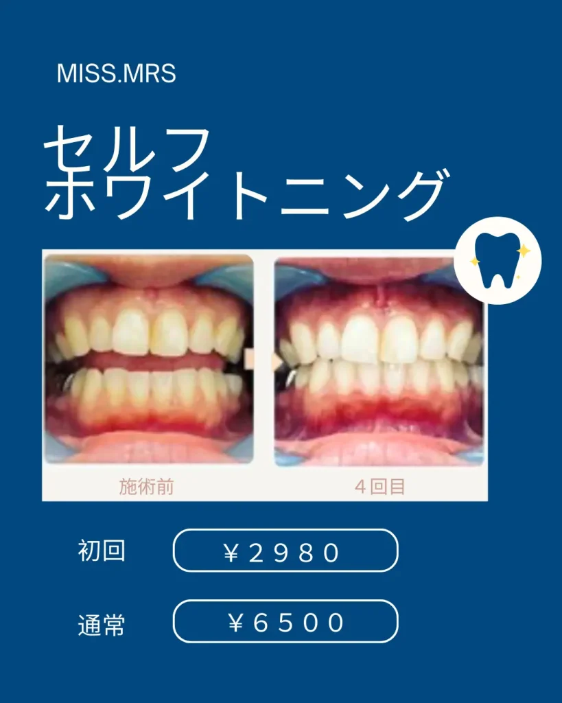 歯のbefore afterぼ写真が並んでいる